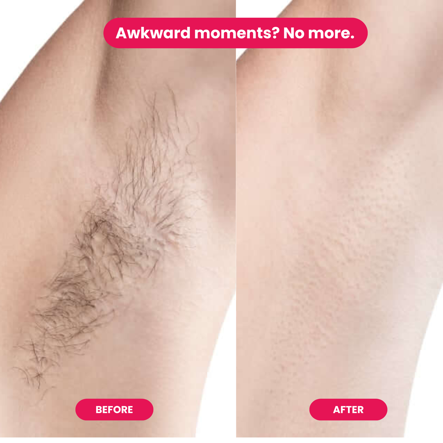 CLOE™|Natural Fuzz-Free Oil